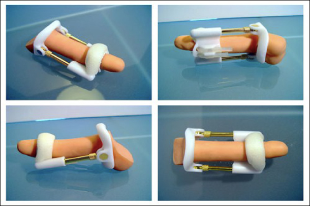 �`���R��傫��������@�I�y�j�X�̃T�C�Y�A�b�v�Ŏ����Ɏ��M���I